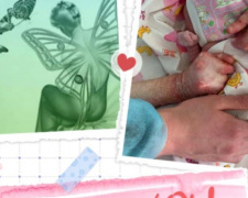 На Днепропетровщине &quot;женщина-бабочка&quot; с тяжелейшим диагнозом родила здорового ребенка