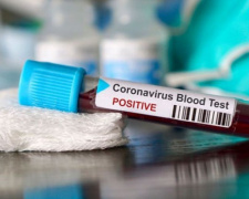 За добу на Дніпропетровщині виявили 104 випадки коронавірусу