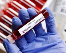 На Дніпропетровщині виявили 296 нових випадків коронавірусу