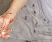 На глазах активиста криворожского автомайдана изрезали мужчину ножом