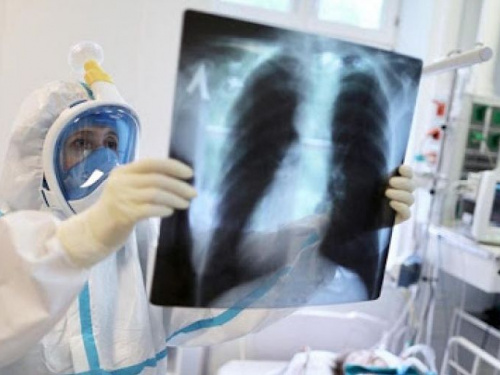 53 пацієнти госпіталізовано з пневмонією у Кривому Розі