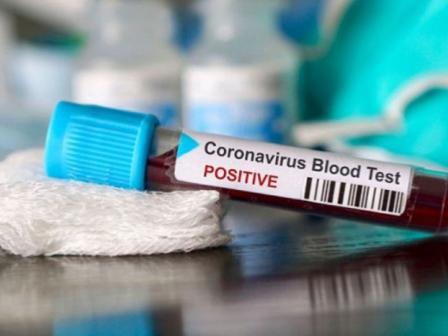 За добу на Дніпропетровщині виявили 104 випадки коронавірусу
