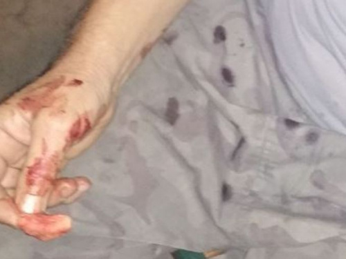 На глазах активиста криворожского автомайдана изрезали мужчину ножом