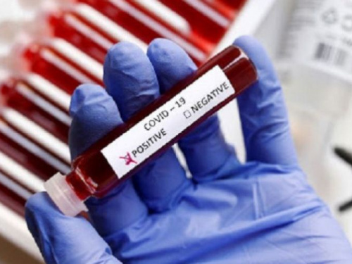 За добу на Дніпропетровщині виявили 297 випадків коронавірусної хвороби