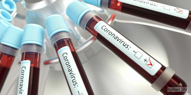 Среди новых 10 случаев коронавируса в Кривом Роге – двое детей и 7-месячный младенец