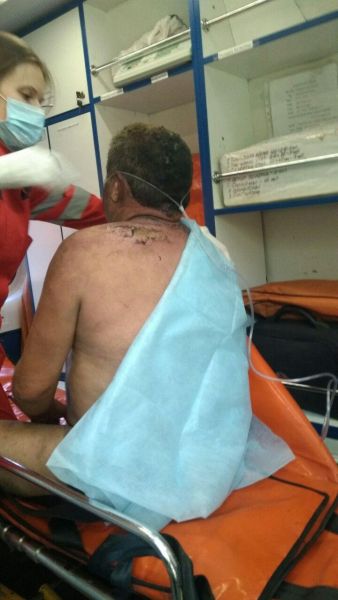 В Кривом Роге спасатели вынесли из огня 57-летнего мужчину