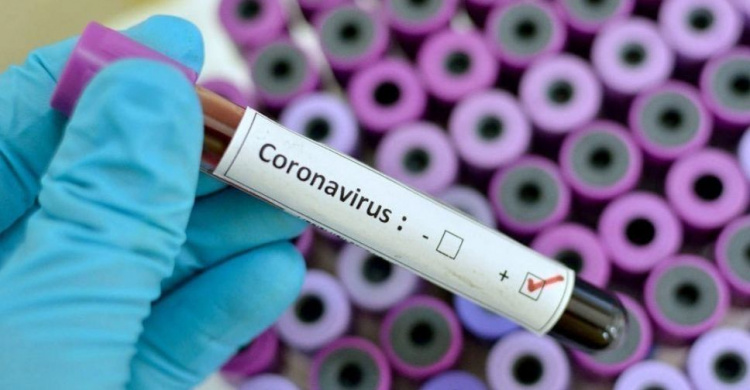 Нові 2 випадки зараження на COVID-19 – у Новомосковську та Кривому Розі. ОНОВЛЮЄТЬСЯ!