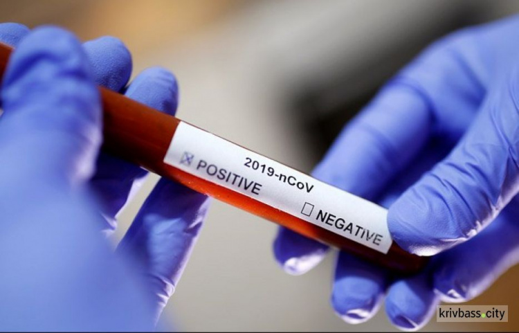 ОНОВЛЕНО: На Дніпропетровщині у Кривому Розі виявили ще один випадок коронавірусу