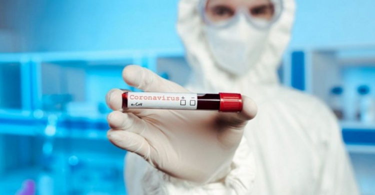 На Дніпропетровщині виявили 105 нових випадків коронавірусу