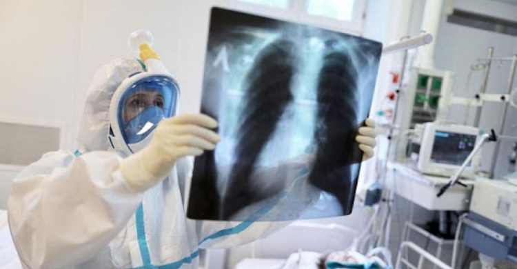56 пацієнтів госпіталізовано з пневмонією у Кривому Розі