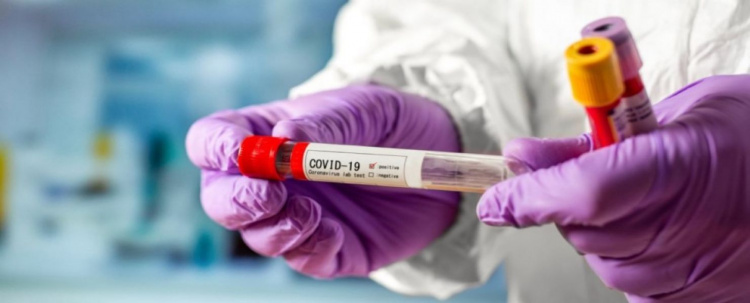 На Днепропетровщине за сутки диагностировали 45 случаев инфицирования COVID-19