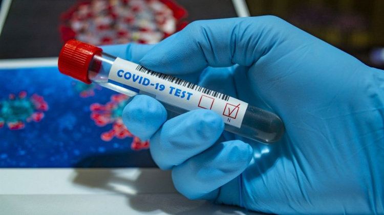 За добу на Дніпропетровщині виявили 34 нові випадки коронавірусу