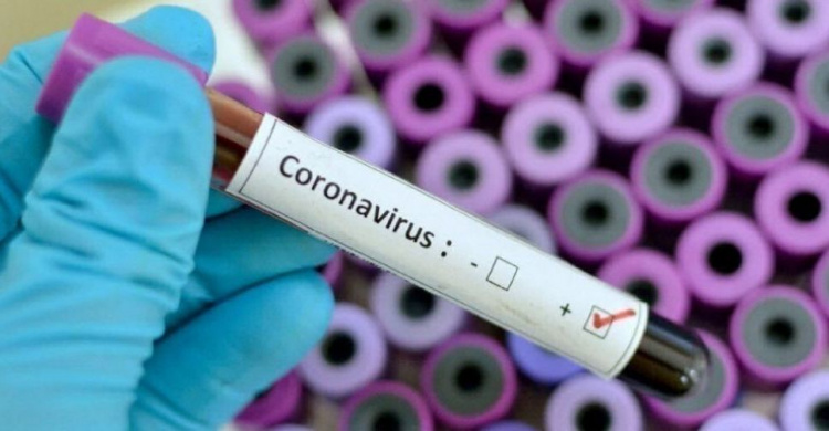 Подробиці  нового випадку зараження коронавірусом у Кривому Розі