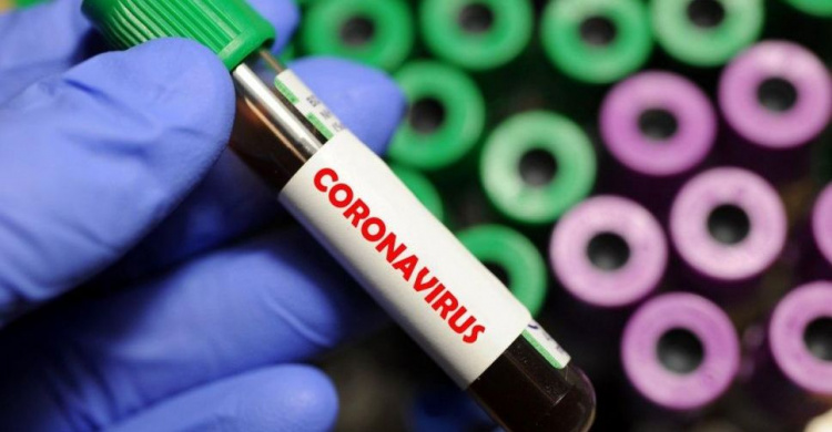 53 нових випадки інфікування Covid-19 зареєстровано у Кривому Розі за минулу добу