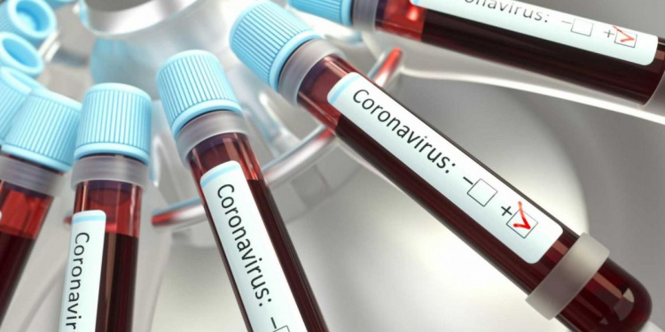 На Днепропетровщине за сутки диагностировали 271 новый случай заражения COVID-19