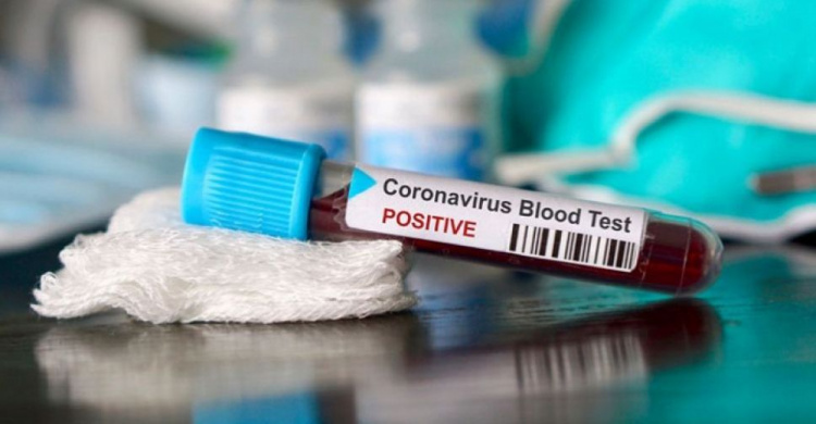 Минулої доби у Кривому Розі зареєстрували 23 нових випадки інфікування коронавірусом