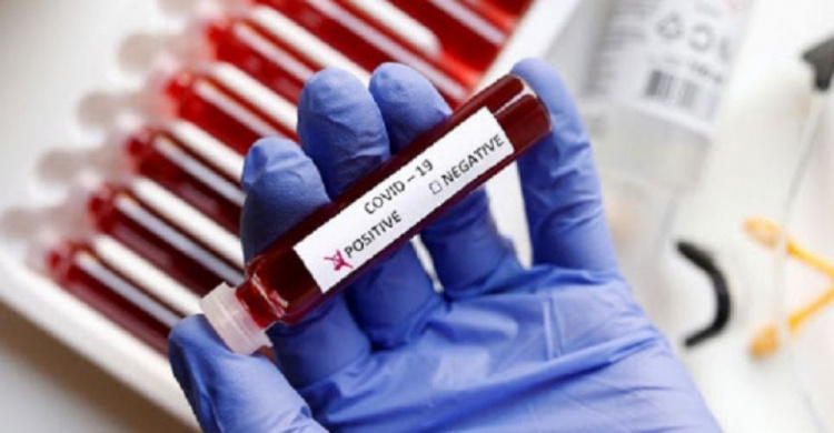 За добу на Дніпропетровщині виявили 297 випадків коронавірусної хвороби
