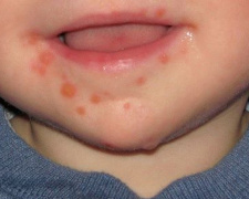 Фото з відкритих джерел