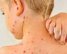 Кір, фото з відкритих джерел 