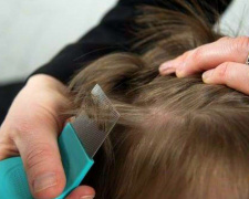 Воші, педикульоз, фото з відкритих джерел