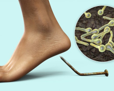 Вакцина могла врятувати: на Дніпропетровщині дитина померла від правця