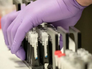 56 пацієнтів госпіталізовано з пневмонією у Кривому Розі