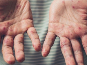 Фото із мережі Інтернет