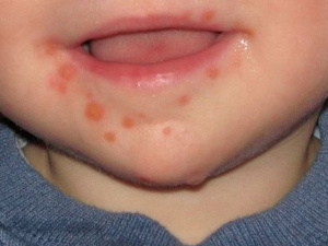 Фото з відкритих джерел