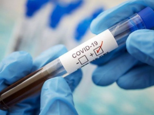 На Дніпропетровщині виявили 259 нових випадків COVID-19. Скільки у Кривому Розі?