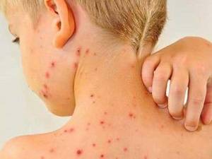 Кір, фото з відкритих джерел 