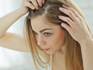 Тісний головний убір: прихована причина облисіння - фото з відкритих джерел