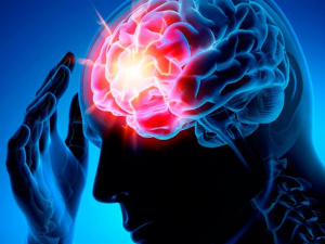 Як розпізнати інсульт: простий тест