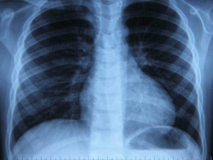 Фото з відкритих джерел