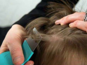 Воші, педикульоз, фото з відкритих джерел