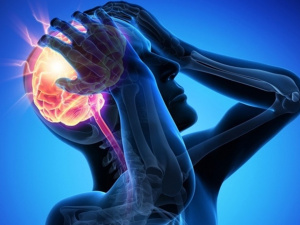 Як вчасно розпізнати інсульт і врятувати життя - фото з відкритих джерел