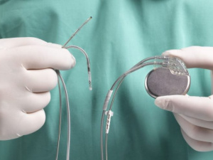 У 2022 році на Дніпропетровщині безкоштовно встановили 750 кардіостимуляторів