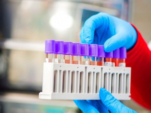 Кривий Ріг - лідер по кількості нових випадків Covid-19 у регіоні 