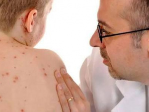 Кір на Дніпропетровщині, фото з відкритих джерел 