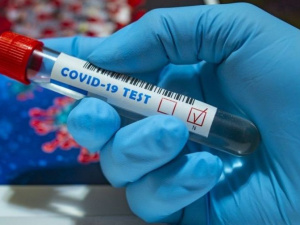 За добу COVID-19 підтвердили у 108 мешканців Дніпропетровщини