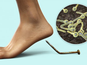 Вакцина могла врятувати: на Дніпропетровщині дитина померла від правця