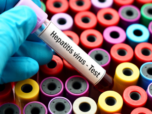 Тестування на вірусні гепатити, фото з відкритих джерел 