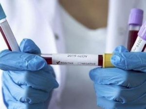 У Кривому Розі виявили 5 нових випадків COVID-19 - Облрада