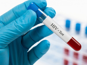 тест на ВІЛ, фото з відкритих джерел 