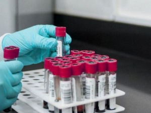 Число випадків зараження штамом «Дельта» в Україні зросло вдвічі - МОЗ