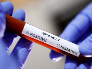 63 людини одужали за минулу добу в Кривому Розі