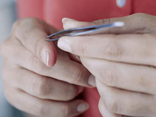 Як дістати скалку з пальця - фото з відкритих джерел