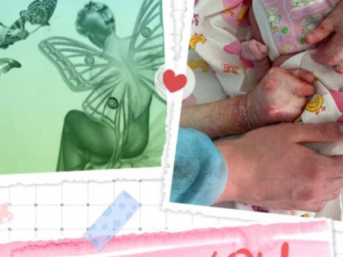 На Днепропетровщине "женщина-бабочка" с тяжелейшим диагнозом родила здорового ребенка