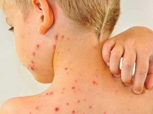 Кір, фото з відкритих джерел 