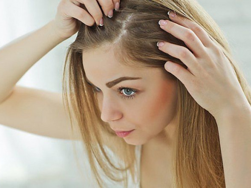 Тісний головний убір: прихована причина облисіння - фото з відкритих джерел