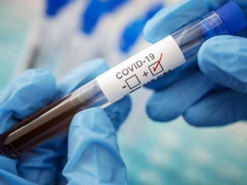 На Дніпропетровщині виявили 960 нових випадків коронавірусу
